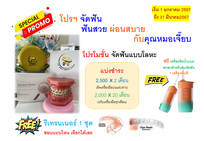 โปรจัดฟัน เริ่ม 1 มกราคม 2567 ถึง 31 มีนาคม 2567